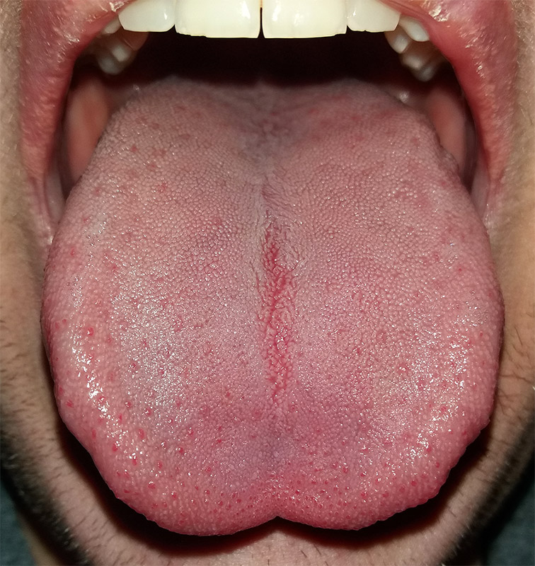 inervacion de la lengua